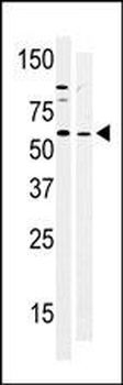BRK (PTK6) Antibody (N-term)