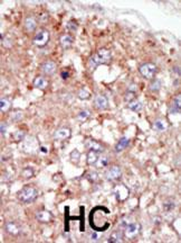 BRK (PTK6) Antibody (N-term)