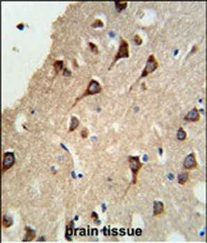 FYN Antibody (N-term)