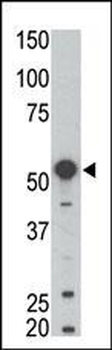 BLK Antibody (N-term)