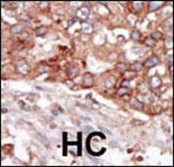 BLK Antibody (N-term)