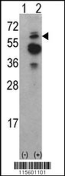 ACK1 Antibody (N-term)