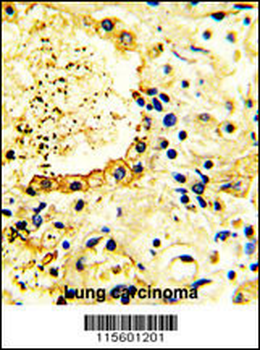 ACK1 Antibody (N-term)
