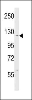 c ABL (ABL1) Antibody (C-term)