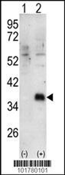 DOK4 Antibody (C-term)