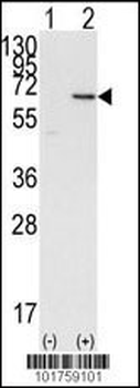 DOK1 Antibody (N-term)