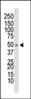 DOK1 Antibody (N-term)