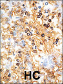 DOK1 Antibody (N-term)