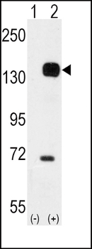 TEK (TIE2) Antibody (C-term)
