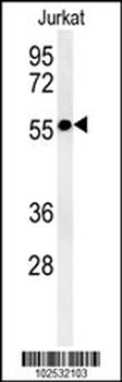 STK33 Antibody (C-term)