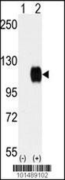 TYRO3 Antibody (C-term)