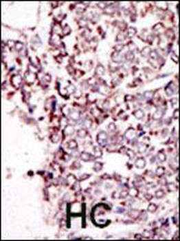 TYRO3 Antibody (C-term)