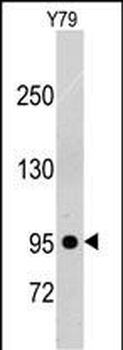 PDGFRB Antibody