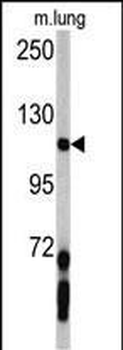 PDGFRA Antibody (C-term E1063)