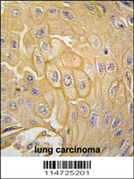 MCK10 Antibody