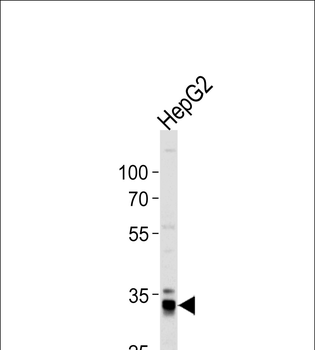 MPST Antibody (N-term)
