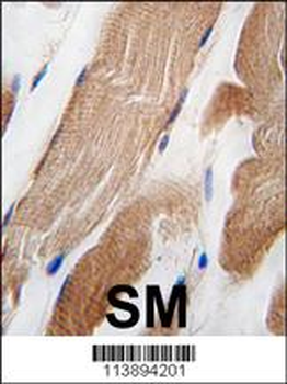 ILK Antibody (T173)