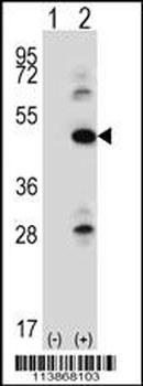ILK Antibody (S246)