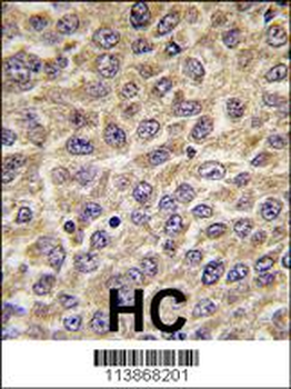 ILK Antibody (S246)