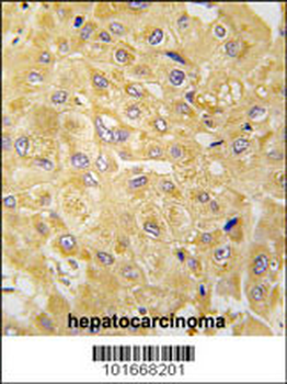 ILK1/ILK2 Antibody (N-term)