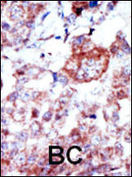 ILK1/ILK2 Antibody (N-term)