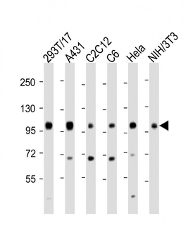 IGF1 Receptor (IGF1R) Antibody (C-term)