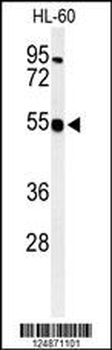 HS2ST1 Antibody (N-term)