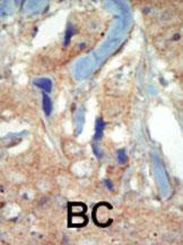 FLT3 (CD135) Antibody (N-term)