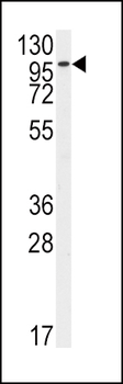FGFR2 Antibody (N-term R22)