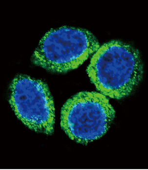 FGFR2 Antibody (N-term R22)