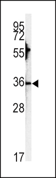 CA3 Antibody (N-term)