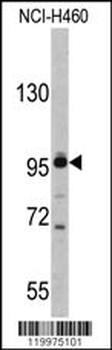 XPOT Antibody (C-term)
