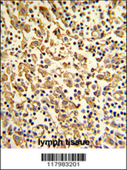 XPOT Antibody (N-term)