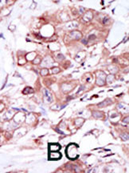 ERBB4 Antibody(C-term)