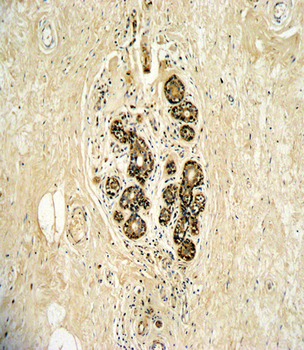 ERBB3 Antibody (N-term)