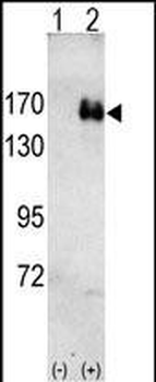 ERBB2 Antibody