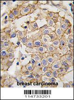 ERBB2 Antibody