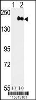 ERBB2 Antibody(C-term Y1248)
