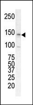 ErbB2 (C-term) Antibody