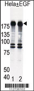 EGFR Antibody (S1070)