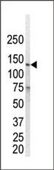 EGFR (ErbB1) Antibody (N-term)