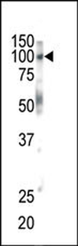 EphB1 Antibody (C-term)