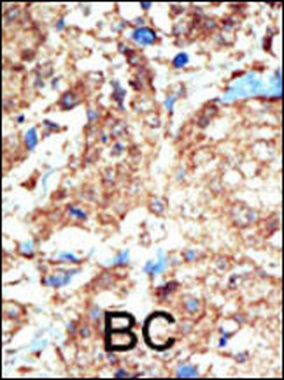 EphB1 Antibody (C-term)