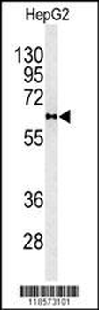 PLTP Antibody (C-term)