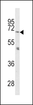 PCSK2 Antibody (N-term)