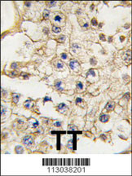 EPHA10 Antibody (N-term)