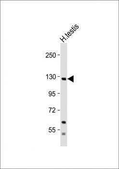 Eph Receptor A6 Antibody (C-term)