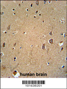 Eph Receptor A6 Antibody (C-term)