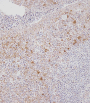 MCSF Receptor (CSF1R) Antibody (C-term)