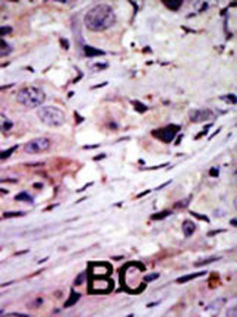 ALK Antibody (C-term)